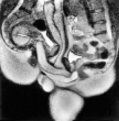 the new MRI sex image by Dr. Pek Van Andel